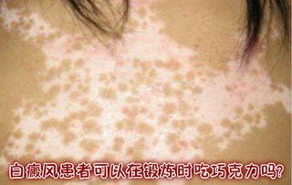 白癜风吃角瓜行吗,白癜风患者的天然食疗选择  第3张