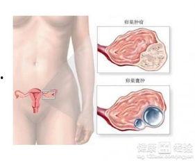 卵巢癌术后可以吃方瓜吗,方瓜的适宜摄入探讨  第2张